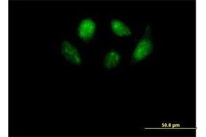 Immunofluorescence of purified MaxPab antibody to SMU1 on HeLa cell. (SMU1 抗体  (AA 1-513))