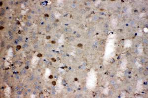 LDHB was detected in paraffin-embedded sections of mouse brain tissues using rabbit anti- LDHB Antigen Affinity purified polyclonal antibody (Catalog # ) at 1 µg/mL.