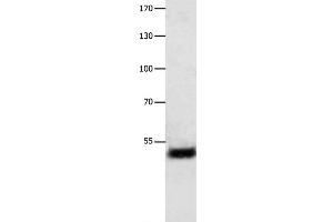 Western Blot analysis of Human liver cancer tissue using EEF1 gamma Polyclonal Antibody at dilution of 1:800 (EEF1G 抗体)