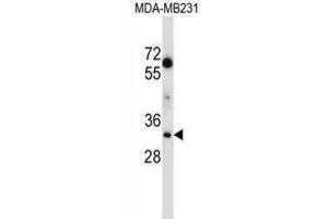 Western Blotting (WB) image for anti-Lactate Dehydrogenase A (LDHA) antibody (ABIN2997387) (Lactate Dehydrogenase A 抗体)