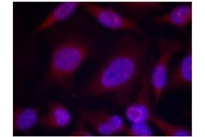 Image no. 1 for anti-Mitogen-Activated Protein Kinase 8 (MAPK8) (pThr183), (pTyr185) antibody (ABIN401562) (JNK 抗体  (pThr183, pTyr185))