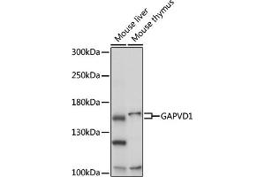 Western blot analysis of extracts of various cell lines, using G antibody (ABIN7267529) at 1:1000 dilution. (GAPVD1 抗体  (AA 1-260))