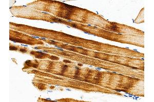 ABIN6259149 and ABIN6275430 at 1/100 staining Mouse muscle tissue by IHC-P. (PDK2 抗体  (Internal Region))