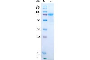 Human IL15RA Protein, hFc Tag on SDS-PAGE under reducing condition.