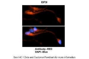 Sample Type: Mouse brain stem cells Primary Antibody Dilution: 1:500Secondary Antibody: Goat anti-rabbit Alexa-Fluor 594 Secondary Antibody Dilution: 1:0000Color/Signal Descriptions: EIF3I: Red DAPI: Blue  Gene Name: EIF3I Submitted by: Dr. (EIF3I 抗体  (C-Term))