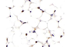 Immunohistochemistry analysis of paraffin-embedded mouse adipose tissue using PPARG Monoclonal Antibody at dilution of 1:1000. (PPARG 抗体)