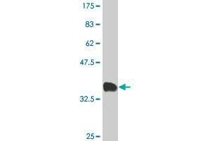 Western Blot detection against Immunogen (34. (CAPZB 抗体  (AA 192-272))