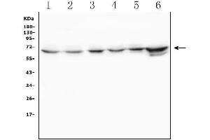Western blot analysis of TDRD3 using anti-TDRD3 antibody (ABIN6719636). (TDRD3 抗体)