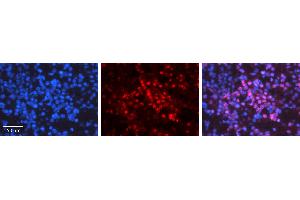 Immunohistochemistry (IHC) image for anti-GA Binding Protein Transcription Factor, alpha Subunit 60kDa (GABPA) (N-Term) antibody (ABIN2777222)