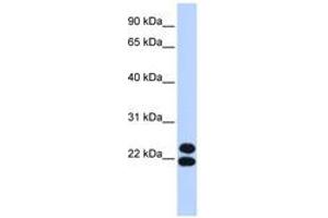 Image no. 1 for anti-Paired Related Homeobox 2 (PRRX2) (AA 35-84) antibody (ABIN6742837) (PRRX2 抗体  (AA 35-84))
