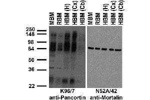 Immunoblot against crude membrane fractions from whole mouse (MBM) or rat (RBM) brain and from human hippocampus [HBM(H)], cerebral cortex [HBM(Cx)] or cerebellum [HBM(Cb)] and probed with K96/7 (left) or N52A/42 (right) TC supe. (Olfactomedin 1 抗体  (pan))