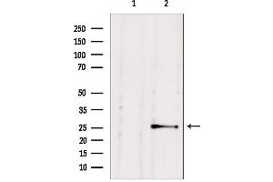 Western blot analysis of extracts from HepG2, using NUDT21 antibody. (NUDT21 抗体  (Internal Region))