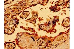 Immunohistochemistry of paraffin-embedded human placenta tissue using ABIN7161270 at dilution of 1:100 (Neurofibromin 1 抗体  (AA 655-892))