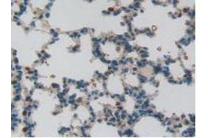 Detection of S100A11 in Rat Lung Tissue using Polyclonal Antibody to S100 Calcium Binding Protein A11 (S100A11)