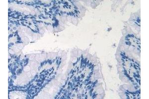 Immunohistochemistry (IHC) image for anti-Nitric Oxide Synthase 1, Neuronal (NOS1) (AA 53-247) antibody (ABIN7437716)