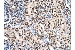 RSU1 antibody was used for immunohistochemistry at a concentration of 4-8 ug/ml. (RSU1 抗体  (C-Term))