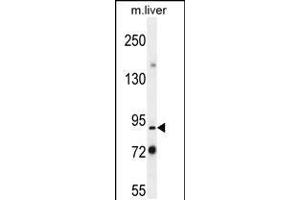 Western blot analysis in mouse liver tissue lysates (35ug/lane). (PARP9 抗体  (N-Term))