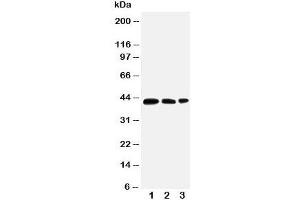 Western blot testing of AQP2 antibody and Lane 1:  MCF-7;  2: SW620;  3: HT1080 cell lysate. (AQP2 抗体  (AA 245-260))