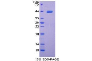 SDS-PAGE (SDS) image for Complement 4 (C4) (AA 975-1336) protein (His tag) (ABIN1980857)