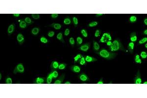 Immunofluorescence analysis of A-549 cells using FIP1L1 Polyclonal Antibody (FIP1L1 抗体)
