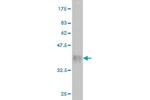 Western Blot detection against Immunogen (36. (RAB38 抗体  (AA 115-211))