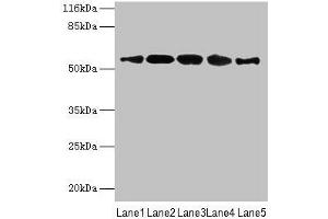 Western blot All lanes: VIPAS39 antibody at 12 μg/mL Lane 1: HepG2 whole cell lysate Lane 2: A431 whole cell lysate Lane 3: 293T whole cell lysate Lane 4: Mouse kidney tissue Lane 5: Hela whole cell lysate Secondary Goat polyclonal to rabbit IgG at 1/10000 dilution Predicted band size: 58, 52 kDa Observed band size: 58 kDa (VIPAR 抗体  (AA 1-493))