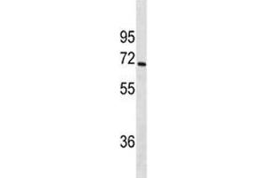 Western Blotting (WB) image for anti-Cytochrome P450, Family 1, Subfamily A, Polypeptide 2 (CYP1A2) (AA 255-282) antibody (ABIN3030675)