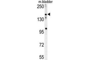 Western Blotting (WB) image for anti-Castor Zinc Finger 1 (CASZ1) antibody (ABIN2995579) (CASZ1 抗体)