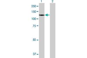 Western Blotting (WB) image for anti-General Transcription Factor IIIC, Polypeptide 2, beta 110kDa (GTF3C2) (AA 1-911) antibody (ABIN516292)