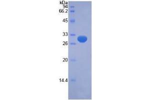 SDS-PAGE analysis of Human PINK1 Protein. (PINK1 蛋白)