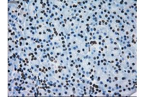 Immunohistochemical staining of paraffin-embedded lung tissue using anti-ERCC1 mouse monoclonal antibody. (ERCC1 抗体)