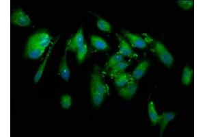Immunofluorescence staining of Hela cells with ABIN7148543 at 1:133, counter-stained with DAPI. (CUTC 抗体  (AA 1-64))
