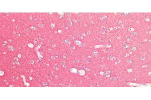 Immunohistochemistry of paraffin-embedded Human Brain using SNAP25 Polyclonal Antibody at dilution of 1:100. (SNAP25 抗体)