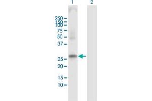 Western Blot analysis of PRSS1 expression in transfected 293T cell line by PRSS1 MaxPab polyclonal antibody. (PRSS1 抗体  (AA 1-247))