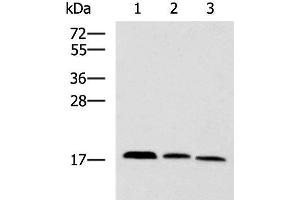 Western blot analysis of Mouse kidney tissue Rat brain tissue Mouse liver tissue lysates using CPLX3 Polyclonal Antibody at dilution of 1:950 (CPLX3 抗体)