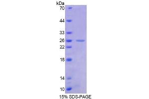 SDS-PAGE (SDS) image for Friend Leukemia Virus Integration 1 (FLI1) (AA 1-196) protein (His tag) (ABIN6238739)