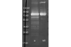 Goat anti Maltose Phosphorylase antibody  was used to detect Maltose Phosphorylase under reducing (R) and non-reducing (NR) conditions. (Maltose Phosphorylase 抗体  (HRP))