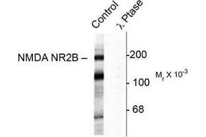 Image no. 1 for anti-Glutamate Receptor, Ionotropic, N-Methyl D-Aspartate 2B (GRIN2B) (pTyr1472) antibody (ABIN372687) (GRIN2B 抗体  (pTyr1472))