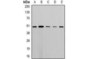 Western blot analysis of MLN64 expression in MCF7 (A), A549 (B), mouse lung (C), mouse heart (D), rat brain (E) whole cell lysates. (STARD3 抗体)