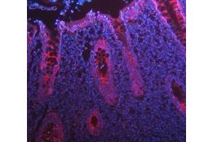 IF analysis of Cytokeratin 8/KRT8 using anti-Cytokeratin 8/KRT8 antibody (ABIN5518853).