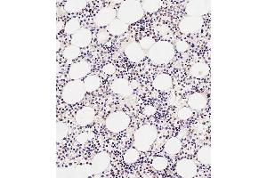 Immunohistochemical analysis of paraffin-embedded Human marrow tissue using A performed on the Leica® BOND RXm. (TAL1 抗体  (AA 68-97))