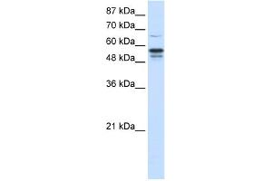 WB Suggested Anti-FOXG1B Antibody Titration:  1. (FOXG1 抗体  (N-Term))