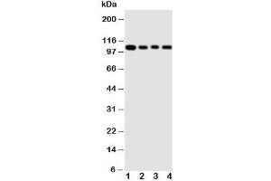 Western blot testing of HSP105 antibody and Lane 1:  rat ovary ;  2: A549 cell  lysate;  3: U87 cell  lysate;  4: HeLa cell  lysate (HSPH1 抗体  (AA 713-733))