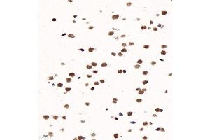 Immunohistochemistry of paraffin embedded rat brain using ZNF682 (ABIN7076270) at dilution of 1:1200 (400x lens) (ZNF682 抗体)