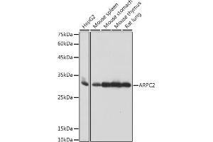 Western blot analysis of extracts of various cell lines, using  antibody (ABIN7265385) at 1:1000 dilution. (ARPC2 抗体)