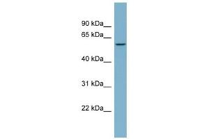 PPP5C antibody used at 1 ug/ml to detect target protein. (PP5 抗体  (N-Term))