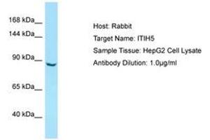 Image no. 1 for anti-Inter alpha Globulin Inhibitor H5 (ITIH5) (AA 77-126) antibody (ABIN6750010) (ITIH5 抗体  (AA 77-126))