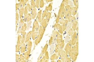 Immunohistochemistry of paraffin-embedded rat heart using CA3 antibody at dilution of 1:100 (x400 lens). (CA3 抗体)