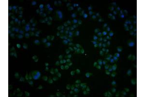 Immunofluorescence staining of Hela cells with ABIN7148793 at 1:100, counter-stained with DAPI. (ATF4 抗体  (AA 20-200))