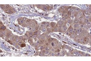 Immunohistochemistry (IHC) image for anti-Solute Carrier Family 2 (Facilitated Glucose Transporter), Member 3 (SLC2A3) (C-Term) antibody (ABIN6261998)
